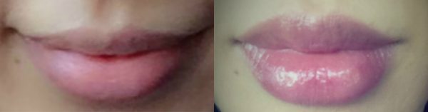 lips